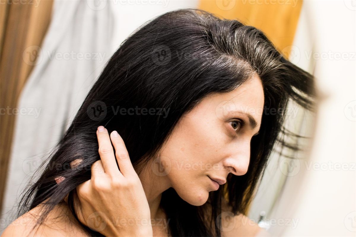 تساقط الشعر عند المرأة: 7 أسباب رئيسية وكيف تعالجينه في 3 أشهر